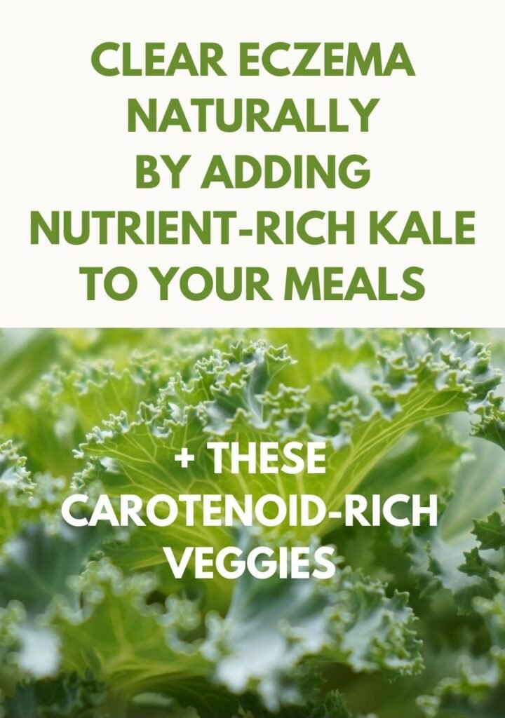 pinterest pin with headline and photo of green kale - a carotenoid-rich vegetable.